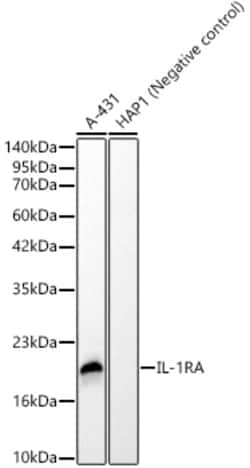 Invitrogen IL1RA Recombinant Rabbit Monoclonal Antibody (6A4M9) 100 &mu;L | Buy Online | Invitrogen&trade; | Fisher Scientific