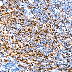 Invitrogen&trade;&nbsp;IRF4 Recombinant Rabbit Monoclonal Antibody (4Z8K2)