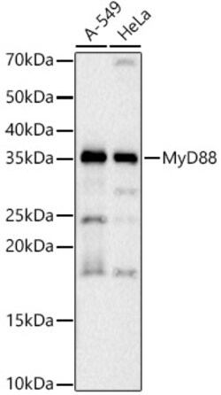 Invitrogen MyD88 Recombinant Rabbit Monoclonal Antibody (0J1O5) 100 &mu;L;