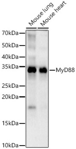 Invitrogen MyD88 Recombinant Rabbit Monoclonal Antibody (0J1O5) 100 &mu;L;