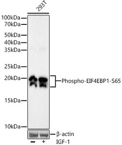 Invitrogen Phospho-4EBP1 (Ser65) Recombinant Rabbit Monoclonal Antibody