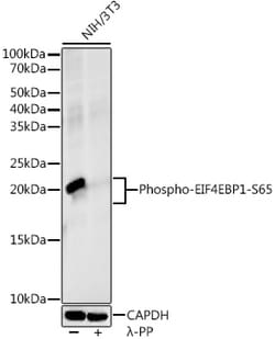 Invitrogen Phospho-4EBP1 (Ser65) Recombinant Rabbit Monoclonal Antibody