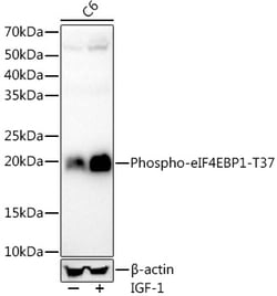 Invitrogen Phospho-4EBP1 (Thr37) Recombinant Rabbit Monoclonal Antibody