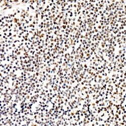 Invitrogen Phospho-PERK (Thr982) Recombinant Rabbit Monoclonal Antibody