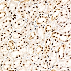 Invitrogen Phospho-PERK (Thr982) Recombinant Rabbit Monoclonal Antibody