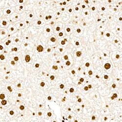 Invitrogen Phospho-PERK (Thr982) Recombinant Rabbit Monoclonal Antibody