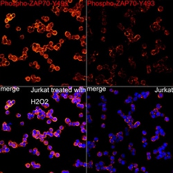 Invitrogen Phospho-Zap-70 (Tyr493) Recombinant Rabbit Monoclonal Antibody