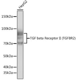 Invitrogen TGFBR2 Recombinant Rabbit Monoclonal Antibody (2M8Y2) 100 &mu;L | Buy Online | Invitrogen&trade; | Fisher Scientific