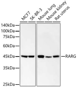 Invitrogen RAR gamma-1,2 Recombinant Rabbit Monoclonal Antibody (9K3Y1)