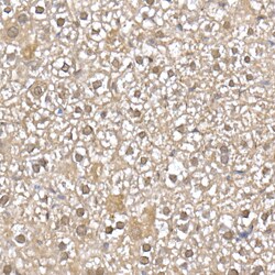Invitrogen UBE2D1 Recombinant Rabbit Monoclonal Antibody (8E6O0) 100 &mu;L;
