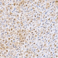 Invitrogen UBE2D1 Recombinant Rabbit Monoclonal Antibody (8E6O0) 100 &mu;L;