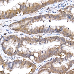 Invitrogen UBE2D1 Recombinant Rabbit Monoclonal Antibody (8E6O0) 100 &mu;L;