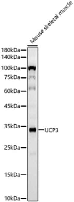 Invitrogen UCP3 Recombinant Rabbit Monoclonal Antibody (10I0J9) 100 &mu;L;