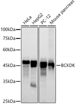 Invitrogen BCKDK Recombinant Rabbit Monoclonal Antibody (5J3L3) 100 &mu;L | Buy Online | Invitrogen&trade; | Fisher Scientific