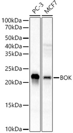 Invitrogen BOK Recombinant Rabbit Monoclonal Antibody (6W4R6) 100 &mu;L;