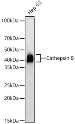 Invitrogen Cathepsin B Recombinant Rabbit Monoclonal Antibody (3X1D6) 100 &mu;L | Buy Online | Invitrogen&trade; | Fisher Scientific