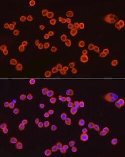 Invitrogen CMTM6 Recombinant Rabbit Monoclonal Antibody (7N3H5) 100 &mu;L;
