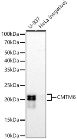 Invitrogen CMTM6 Recombinant Rabbit Monoclonal Antibody (7N3H5) 100 &mu;L;