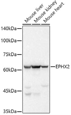 Invitrogen EPHX2 Recombinant Rabbit Monoclonal Antibody (8E2X2) 100 &mu;L;
