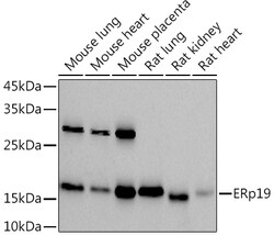Invitrogen TXNDC12 Recombinant Rabbit Monoclonal Antibody (9J6L2) 100 &mu;L;