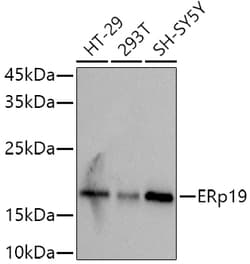 Invitrogen TXNDC12 Recombinant Rabbit Monoclonal Antibody (9J6L2) 100 &mu;L;