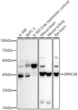 Invitrogen GPRC5B Recombinant Rabbit Monoclonal Antibody (8Y9J4) 100 &mu;L;