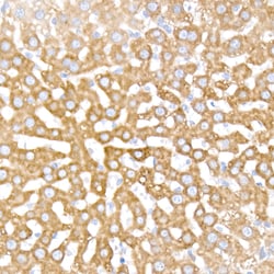 Invitrogen INSIG1 Recombinant Rabbit Monoclonal Antibody (0Q2B5) 100 &mu;L;