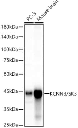 Invitrogen KCNN3 Recombinant Rabbit Monoclonal Antibody (3G7W0) 100 &mu;L;