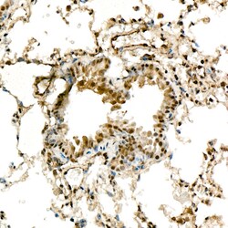 Invitrogen METTL4 Recombinant Rabbit Monoclonal Antibody (9N4K4) 100 &mu;L;