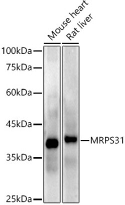 Invitrogen MRPS31 Recombinant Rabbit Monoclonal Antibody (3J3T5) 100 &mu;L;