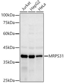 Invitrogen MRPS31 Recombinant Rabbit Monoclonal Antibody (3J3T5) 100 &mu;L;