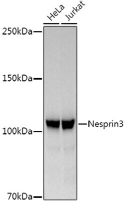Invitrogen™ SYNE3 Recombinant Rabbit Monoclonal Antibody (5P10J3)