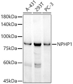 Invitrogen NPHP1 Recombinant Rabbit Monoclonal Antibody (6T10Z4) 100 &mu;L;