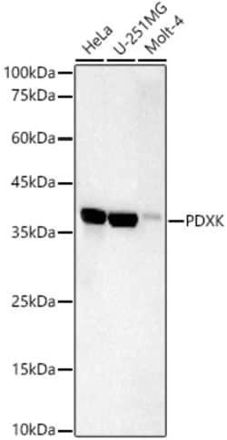 Invitrogen PDXK Recombinant Rabbit Monoclonal Antibody (5N4M3) 100 &mu;L | Buy Online | Invitrogen&trade; | Fisher Scientific