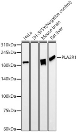 Invitrogen PLA2R1 Recombinant Rabbit Monoclonal Antibody (7I4Z1) 100 &mu;L;