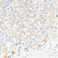 Invitrogen Plectin Recombinant Rabbit Monoclonal Antibody (9O0B3) 100 &mu;L;