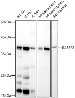 Invitrogen RASSF2 Recombinant Rabbit Monoclonal Antibody (5U1E0) 100 &mu;L;