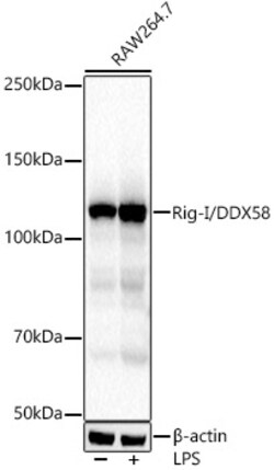 Invitrogen RIG-I Recombinant Rabbit Monoclonal Antibody (2J8D5) 100 &mu;L;