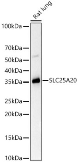 Invitrogen SLC25A20 Recombinant Rabbit Monoclonal Antibody (3J1L5) 100