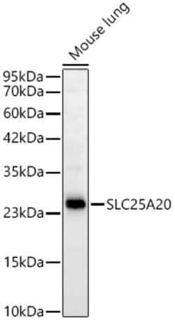 Invitrogen SLC25A20 Recombinant Rabbit Monoclonal Antibody (3J1L5) 100