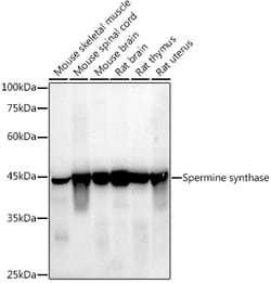 Invitrogen SMS Recombinant Rabbit Monoclonal Antibody (1U7C7) 100 &mu;L;