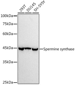 Invitrogen SMS Recombinant Rabbit Monoclonal Antibody (1U7C7) 100 &mu;L;