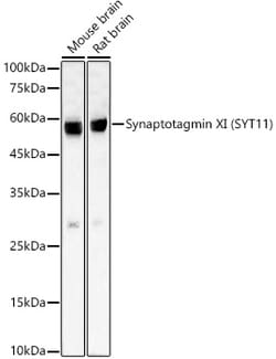 Invitrogen™ SYT11 Recombinant Rabbit Monoclonal Antibody (2M4R9)
