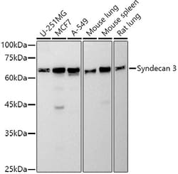 Invitrogen Syndecan 3 Recombinant Rabbit Monoclonal Antibody (6K5Y9) 100 &mu;L | Buy Online | Invitrogen&trade; | Fisher Scientific