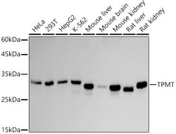 Invitrogen TPMT Recombinant Rabbit Monoclonal Antibody (4P2U9) 100 &mu;L;