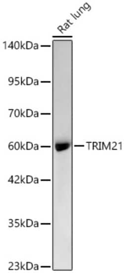 Invitrogen TRIM21 Recombinant Rabbit Monoclonal Antibody (7X9I8) 100 &mu;L;