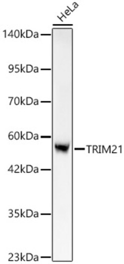 Invitrogen TRIM21 Recombinant Rabbit Monoclonal Antibody (7X9I8) 100 &mu;L;