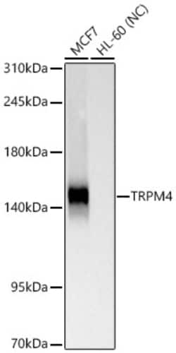 Invitrogen TRPM4 Recombinant Rabbit Monoclonal Antibody (5L6V0) 100 &mu;L | Buy Online | Invitrogen&trade; | Fisher Scientific