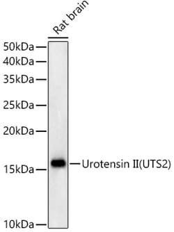 Invitrogen UTS2 Recombinant Rabbit Monoclonal Antibody (3B2M6) 100 &mu;L | Buy Online | Invitrogen&trade; | Fisher Scientific