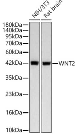Invitrogen WNT2 Recombinant Rabbit Monoclonal Antibody (6W3P9) 100 &mu;L | Buy Online | Invitrogen&trade; | Fisher Scientific